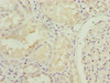 Immunohistochemistry of paraffin-embedded human kidney tissue using CSB-PA880968LA01HU at dilution of 1:100