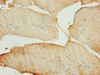 Immunohistochemistry of paraffin-embedded human skeletal muscle tissue using CSB-PA880971DA01HU at dilution of 1:100