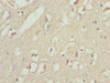 Immunohistochemistry of paraffin-embedded human brain tissue using CSB-PA880971DA01HU at dilution of 1:100