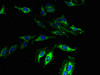 Immunofluorescent analysis of Hela cells using CSB-PA882095LA01HU at dilution of 1:100 and Alexa Fluor 488-congugated AffiniPure Goat Anti-Rabbit IgG (H+L)