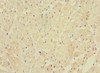 Immunohistochemistry of paraffin-embedded human heart tissue using CSB-PA883385LA01HU at dilution of 1:100