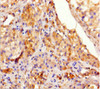 Immunohistochemistry of paraffin-embedded human testis tissue using CSB-PA883626LA01HU at dilution of 1:100