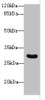 Western blot<br />
 All lanes: Snrnp35 antibody at 12µg/ml + Jurkat whole cell lysate<br />
 Secondary<br />
 Goat polyclonal to rabbit IgG at 1/10000 dilution<br />
 Predicted band size: 29 kDa<br />
 Observed band size: 29 kDa<br />