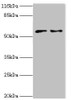 Western blot<br />
 All lanes: CRISPLD2 antibody at 2µg/ml<br />
 Lane 1: Jurkat whole cell lysate<br />
 Lane 2: CEM whole cell lysate<br />
 Secondary<br />
 Goat polyclonal to rabbit IgG at 1/10000 dilution<br />
 Predicted band size: 56, 52, 43, 18, 14 kDa<br />
 Observed band size: 56 kDa<br />