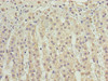 Immunohistochemistry of paraffin-embedded human adrenal gland tissue using CSB-PA884484LA01HU at dilution of 1:100