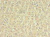 Immunohistochemistry of paraffin-embedded human liver tissue using CSB-PA885720LA01HU at dilution of 1:100