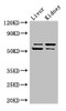Western Blot<br />
 Positive WB detected in: Mouse liver tissue, Mouse kidney tissue<br />
 All lanes: LMBRD1 antibody at 4µg/ml<br />
 Secondary<br />
 Goat polyclonal to rabbit IgG at 1/50000 dilution<br />
 Predicted band size: 62, 45, 54, 22 kDa<br />
 Observed band size: 62, 54 kDa<br />