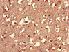 Immunohistochemistry of paraffin-embedded human brain tissue using CSB-PA885730LA01HU at dilution of 1:100