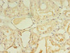 Immunohistochemistry of paraffin-embedded human kidney tissue using CSB-PA885767LA01HU at dilution of 1:100