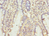 Immunohistochemistry of paraffin-embedded human small intestine tissue using CSB-PA885782LA01HU at dilution of 1:100