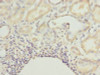 Immunohistochemistry of paraffin-embedded human kidney tissue using CSB-PA885782LA01HU at dilution of 1:100