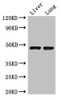 Western Blot<br />
 Positive WB detected in: Mouse liver tissue, Mouse lung tissue<br />
 All lanes: SEC14L3 antibody at 3µg/ml<br />
 Secondary<br />
 Goat polyclonal to rabbit IgG at 1/50000 dilution<br />
 Predicted band size: 47 kDa<br />
 Observed band size: 47 kDa<br />
