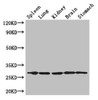 Western Blot<br />
 Positive WB detected in: Mouse spleen tissue, , Mouse lung tissue, Mouse kidney tissue, Mouse brain tissue, Mouse stomach tissue<br />
 All lanes: RTP3 antibody at 3µg/ml<br />
 Secondary<br />
 Goat polyclonal to rabbit IgG at 1/50000 dilution<br />
 Predicted band size: 28 kDa<br />
 Observed band size: 28 kDa<br />