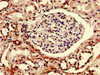 Immunohistochemistry of paraffin-embedded human kidney tissue using CSB-PA887106LA01HU at dilution of 1:100