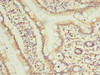 Immunohistochemistry of paraffin-embedded human small intestine tissue using CSB-PA887181LA01HU at dilution of 1:100