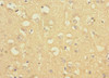Immunohistochemistry of paraffin-embedded human brain tissue using CSB-PA888027LA01HU at dilution of 1:100 Immunohistochemistry of paraffin-embedded human brain tissue using CSB-PA888027LA01HU at dilution of 1:100