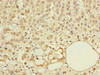 Immunohistochemistry of paraffin-embedded human adrenal gland tissue using CSB-PA889115LA01HU at dilution of 1:100