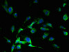 Immunofluorescent analysis of U251 cells using CSB-PA889118HA01HU at dilution of 1:100 and Alexa Fluor 488-congugated AffiniPure Goat Anti-Rabbit IgG (H+L) Immunofluorescent analysis of U251 cells using CSB-PA889118HA01HU at dilution of 1:100 and Alexa Fluor 488-congugated AffiniPure Goat Anti-Rabbit IgG (H+L)