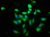 Immunofluorescence staining of Hela cells cells with CSB-PA889130LA01HU at 1: 200, counter-stained with DAPI. The cells were fixed in 4% formaldehyde, permeabilized tissue using 0.2% Triton X-100 and blocked in 10% normal Goat Serum. The cells were then incubated with the antibody overnight at 4°C.The secondary antibody was Alexa Fluor 488-congugated AffiniPure Goat Anti-Rabbit IgG (H+L) .