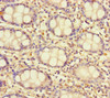 Immunohistochemistry of paraffin-embedded human colon tissue using CSB-PA889153LA01HU at dilution of 1:100