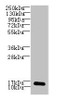 Western blot<br />
 All lanes: LSM7 antibody at 3µg/ml + HepG2 whole cell lysate<br />
 Secondary<br />
 Goat polyclonal to rabbit IgG at 1/10000 dilution<br />
 Predicted band size: 12 kDa<br />
 Observed band size: 12 kDa<br />