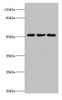 Western blot<br />
 All lanes: BAG5 antibody at 2µg/ml<br />
 Lane 1: Mouse kidney tissue<br />
 Lane 2: Mouse brain tissue<br />
 Lane 3: Hela whole cell lysate<br />
 Secondary<br />
 Goat polyclonal to rabbit IgG at 1/10000 dilution<br />
 Predicted band size: 52, 57 kDa<br />
 Observed band size: 52 kDa<br />
