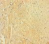 Immunohistochemistry of paraffin-embedded human heart tissue using CSB-PA890917LA01HU at dilution of 1:100