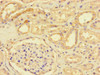 Immunohistochemistry of paraffin-embedded human kidney tissue using CSB-PA890925LA01HU at dilution of 1:100