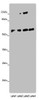 Western blot<br />
 All lanes: ANGPTL2 antibody at 8µg/ml<br />
 Lane 1: Mouse spleen tissue<br />
 Lane 2: K562 whole cell lysate<br />
 Lane 3: Hela whole cell lysate<br />
 Lane 4: A549 whole cell lysate<br />
 Secondary<br />
 Goat polyclonal to rabbit IgG at 1/10000 dilution<br />
 Predicted band size: 58, 23 kDa<br />
 Observed band size: 58 kDa<br />