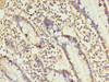 Immunohistochemistry of paraffin-embedded human small intestine tissue using CSB-PA891539YA01HU at dilution of 1:100