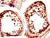 IHC image of CSB-PA891553LA01HU diluted at 1:600 and staining in paraffin-embedded human testis tissue performed on a Leica BondTM system. After dewaxing and hydration, antigen retrieval was mediated by high pressure in a citrate buffer (pH 6.0) . Section was blocked with 10% normal goat serum 30min at RT. Then primary antibody (1% BSA) was incubated at 4°C overnight. The primary is detected by a biotinylated secondary antibody and visualized using an HRP conjugated SP system.
