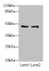 Western blot<br />
 All lanes: GPR34 antibody at 8µg/ml<br />
 Lane 1: Mouse liver tissue<br />
 Lane 2: Mouse kidney tissue<br />
 Secondary<br />
 Goat polyclonal to rabbit IgG at 1/10000 dilution<br />
 Predicted band size: 44 kDa<br />
 Observed band size: 44 kDa<br />