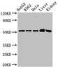 Western Blot<br />
 Positive WB detected in: HepG2 whole cell lysate, K562 whole cell lysate, Hela whole cell lysate, Mouse liver tissue, Mouse kidney tissue<br />
 All lanes: FBXW2 antibody at 3µg/ml<br />
 Secondary<br />
 Goat polyclonal to rabbit IgG at 1/50000 dilution<br />
 Predicted band size: 52, 45 kDa<br />
 Observed band size: 52 kDa<br />