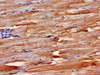 Immunohistochemistry of paraffin-embedded human skeletal muscle tissue using CSB-PA891730LA01HU at dilution of 1:100