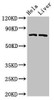 Western Blot<br />
 Positive WB detected in: Hela whole cell lysate, Rat liver tissue<br />
 All lanes: ACSL5 antibody at 3µg/ml<br />
 Secondary<br />
 Goat polyclonal to rabbit IgG at 1/50000 dilution<br />
 Predicted band size: 76, 83, 74, kDa<br />
 Observed band size: 76 kDa<br />