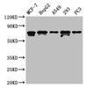 Western Blot<br />
 Positive WB detected in: MCF-7 whole cell lysate, HepG2 whole cell lysate, A549 whole cell lysate, 293 whole cell lysate, PC-3 whole cell lysate<br />
 All lanes: MAGED2 antibody at 4.5µg/ml<br />
 Secondary<br />
 Goat polyclonal to rabbit IgG at 1/50000 dilution<br />
 Predicted band size: 65, 64 kDa<br />
 Observed band size: 65, 64 kDa<br />