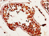 IHC image of CSB-PA891976LA01HU diluted at 1:320 and staining in paraffin-embedded human testis tissue performed on a Leica BondTM system. After dewaxing and hydration, antigen retrieval was mediated by high pressure in a citrate buffer (pH 6.0) . Section was blocked with 10% normal goat serum 30min at RT. Then primary antibody (1% BSA) was incubated at 4°C overnight. The primary is detected by a biotinylated secondary antibody and visualized using an HRP conjugated SP system.