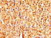 IHC image of CSB-PA891976LA01HU diluted at 1:320 and staining in paraffin-embedded human adrenal gland tissue performed on a Leica BondTM system. After dewaxing and hydration, antigen retrieval was mediated by high pressure in a citrate buffer (pH 6.0) . Section was blocked with 10% normal goat serum 30min at RT. Then primary antibody (1% BSA) was incubated at 4°C overnight. The primary is detected by a biotinylated secondary antibody and visualized using an HRP conjugated SP system.