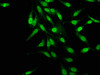 Immunofluorescence staining of Hela cells with CSB-PA891976LA01HU at 1:145, counter-stained with DAPI. The cells were fixed in 4% formaldehyde, permeabilized using 0.2% Triton X-100 and blocked in 10% normal Goat Serum. The cells were then incubated with the antibody overnight at 4°C. The secondary antibody was Alexa Fluor 488-congugated AffiniPure Goat Anti-Rabbit IgG (H+L) .