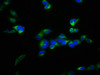 Immunofluorescence staining of Hela cells with CSB-PA892134LA01HU at 1:100, counter-stained with DAPI. The cells were fixed in 4% formaldehyde, permeabilized using 0.2% Triton X-100 and blocked in 10% normal Goat Serum. The cells were then incubated with the antibody overnight at 4°C. The secondary antibody was Alexa Fluor 488-congugated AffiniPure Goat Anti-Rabbit IgG (H+L) .