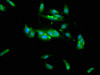 Immunofluorescence staining of Hela cells with CSB-PA892166LA01HU at 1:133, counter-stained with DAPI. The cells were fixed in 4% formaldehyde, permeabilized using 0.2% Triton X-100 and blocked in 10% normal Goat Serum. The cells were then incubated with the antibody overnight at 4°C. The secondary antibody was Alexa Fluor 488-congugated AffiniPure Goat Anti-Rabbit IgG (H+L) .