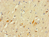 Immunohistochemistry of paraffin-embedded human brain tissue using CSB-PA892366LA01HU at dilution of 1:100