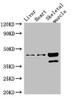 Western Blot<br />
 Positive WB detected in: Mouse liver tissue, Mouse heart tissue, Mouse skeletal muscle tissue<br />
 All lanes: ACAD8 antibody at 3µg/ml<br />
 Secondary<br />
 Goat polyclonal to rabbit IgG at 1/50000 dilution<br />
 Predicted band size: 46, 32, 39 kDa<br />
 Observed band size: 46, 39 kDa<br />