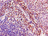 Immunohistochemistry of paraffin-embedded human tonsil tissue using CSB-PA892457LA01HU at dilution of 1:100