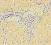 Immunohistochemistry of paraffin-embedded human liver tissue using CSB-PA892486LA01HU at dilution of 1:100