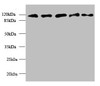 Western blot<br />
 All lanes: MORC2 antibody at 6µg/ml<br />
 Lane 1: U87 whole cell lysate<br />
 Lane 2: U251 whole cell lysate<br />
 Lane 3: Jurkat whole cell lysate<br />
 Lane 4: Hela whole cell lysate<br />
 Lane 5: MCF-7 whole cell lysate<br />
 Secondary<br />
 Goat polyclonal to rabbit IgG at 1/10000 dilution<br />
 Predicted band size: 118, 111 kDa<br />
 Observed band size: 118 kDa<br />