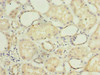 Immunohistochemistry of paraffin-embedded human kidney tissue using CSB-PA896759LA01HU at dilution of 1:100