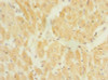 Immunohistochemistry of paraffin-embedded human heart tissue using CSB-PA897086LA01HU at dilution of 1:100