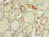 Immunohistochemistry of paraffin-embedded human thyroid tissue using CSB-PA897460LA01HU at dilution of 1:100
