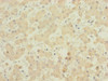 Immunohistochemistry of paraffin-embedded human liver tissue using CSB-PA897465LA01HU at dilution of 1:100